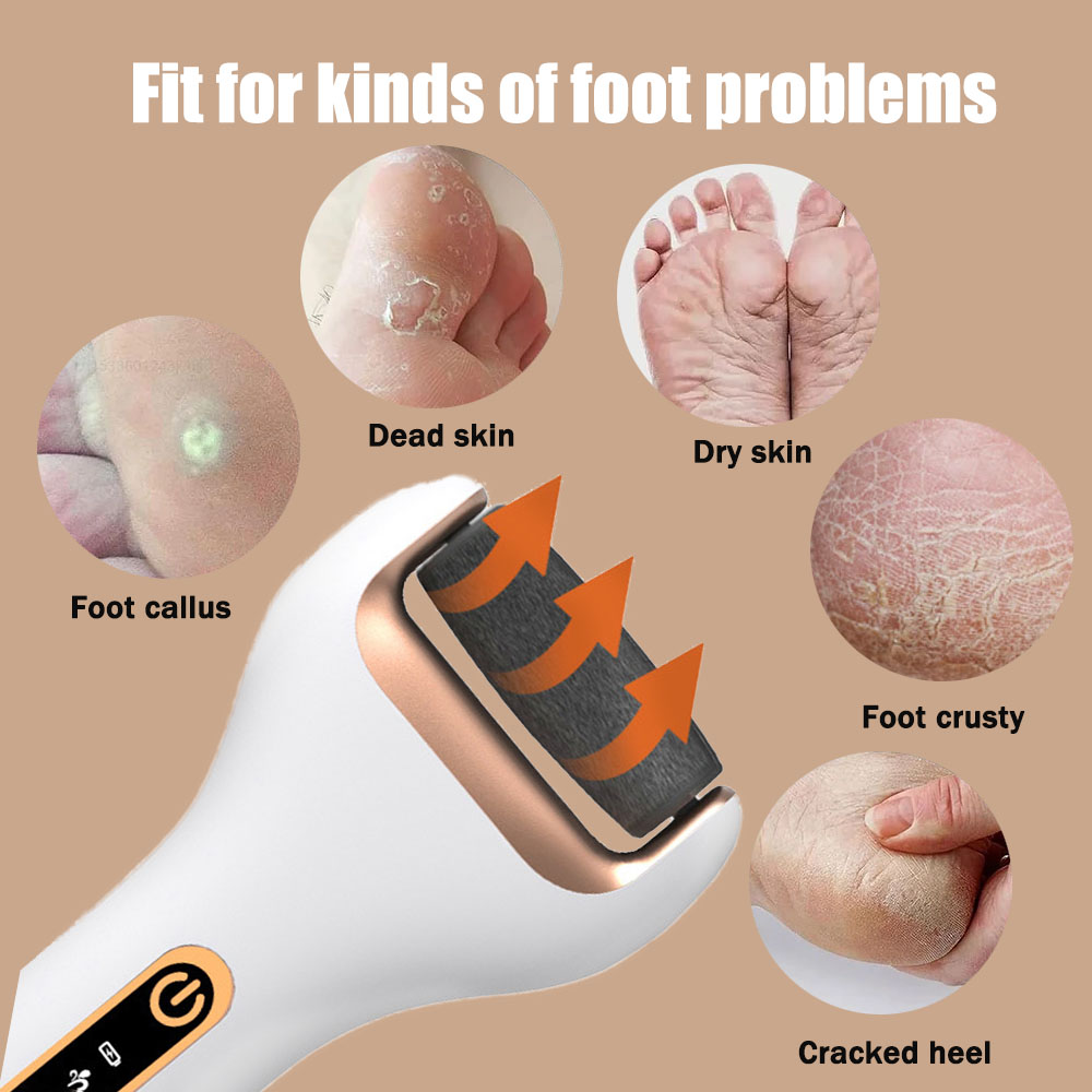 Rechargeable Electric Foot Ras - Woodworking Rasp review and price